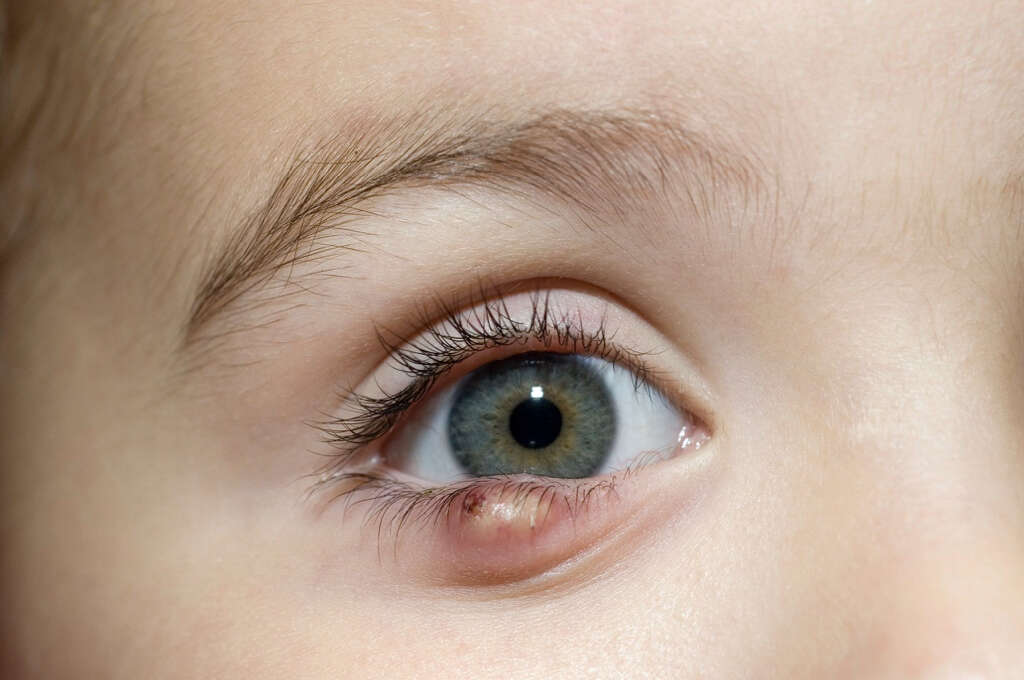 Red Eyes