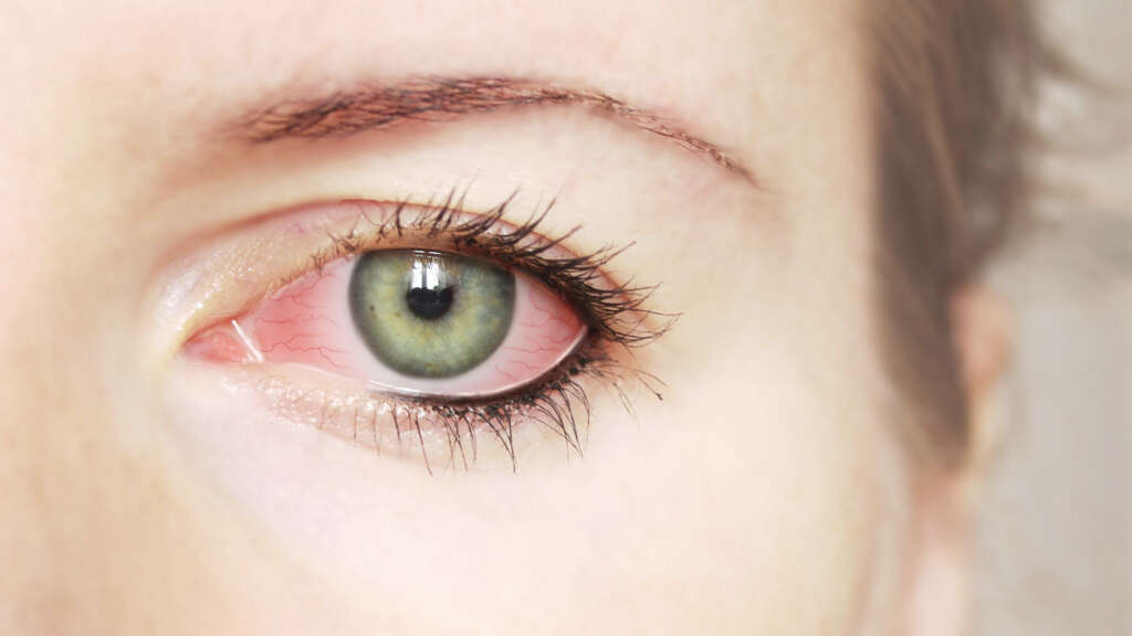 Red Eyes